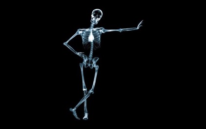 Man standing X Ray-602x376